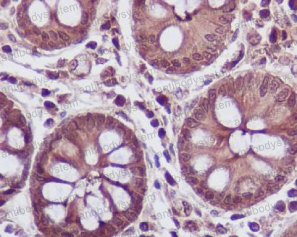 Anti-LDHA Antibody (R1B36)