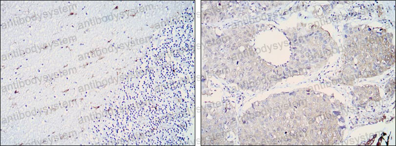 Anti-ALDH1A1 Antibody (R2W65)