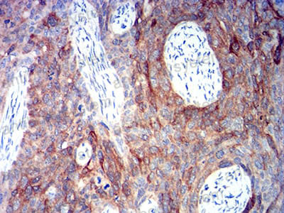 Anti-ALDH1A1 Antibody (R2W67)