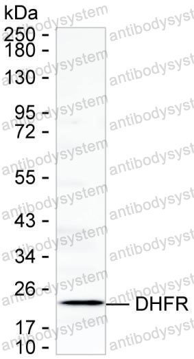 Anti-DHFR Antibody (R2W68)