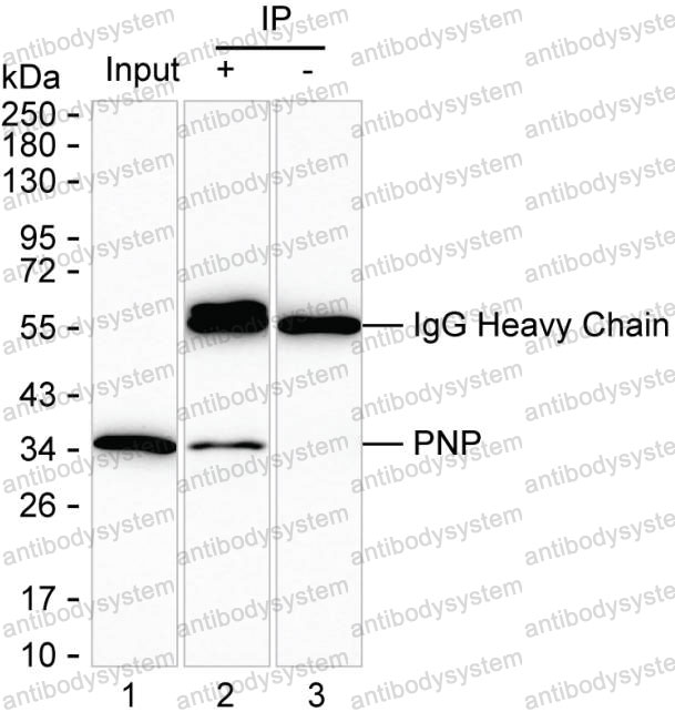 Anti-PNP Antibody (R2W71)