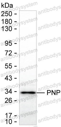 Anti-PNP Antibody (R2W70)