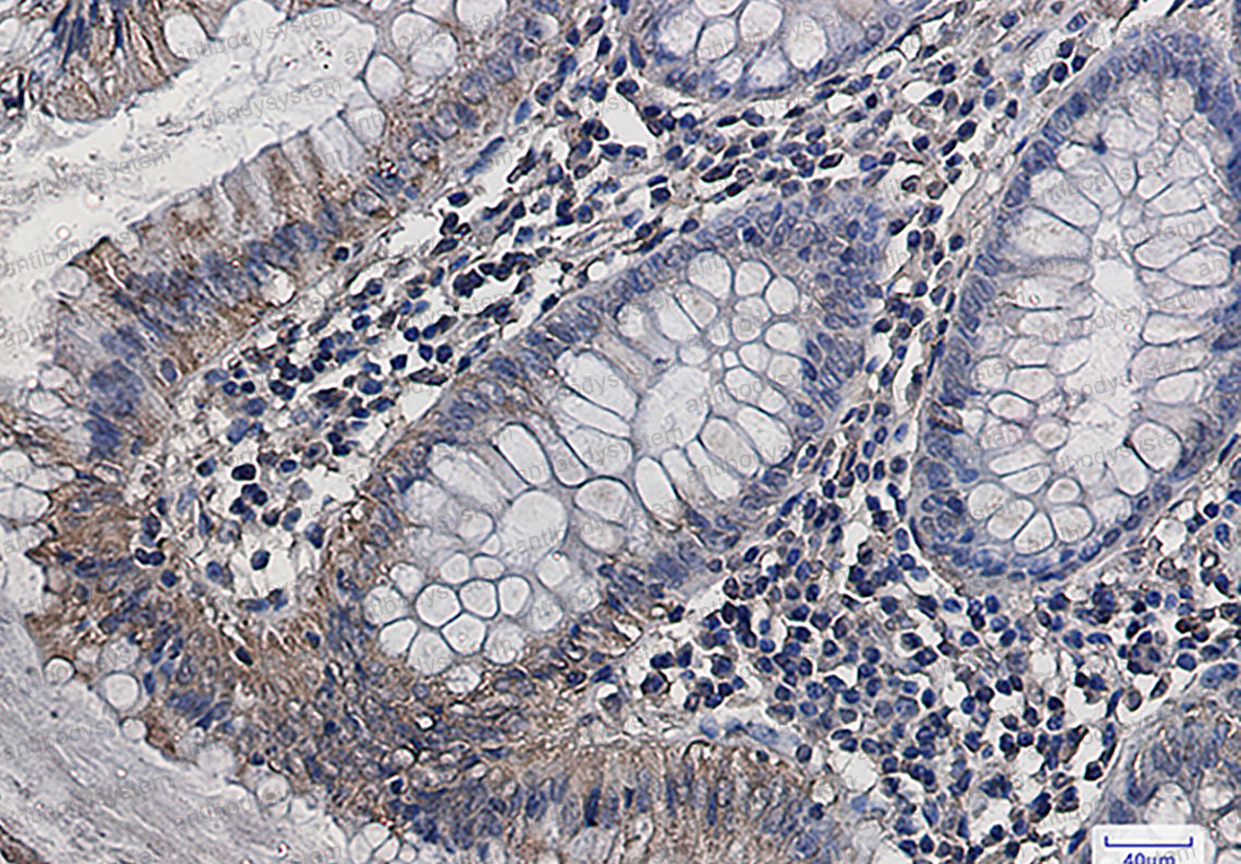 Anti-GOT2 Antibody (R1H27)