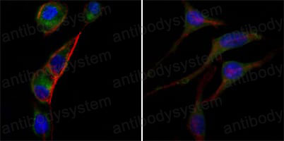 Anti-GOT2 Antibody (R2W73)