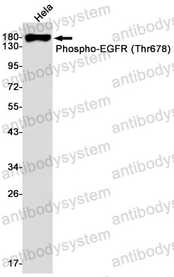 Anti-Phospho-EGFR/ERBB1/HER1 (Thr678) Antibody (R1H28)