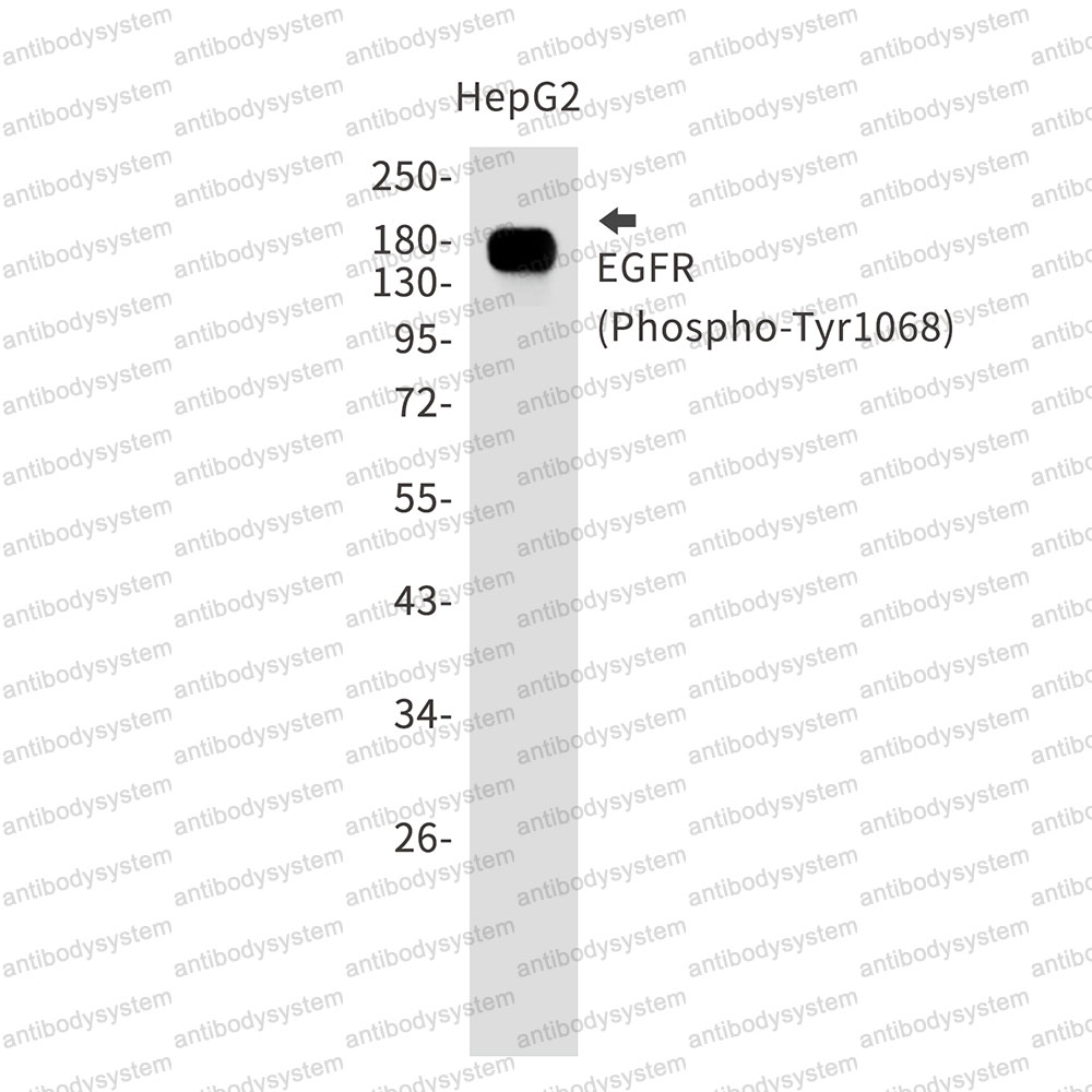Anti-Phospho-EGFR/ERBB1/HER1 (Tyr1068) Antibody (R1H29)