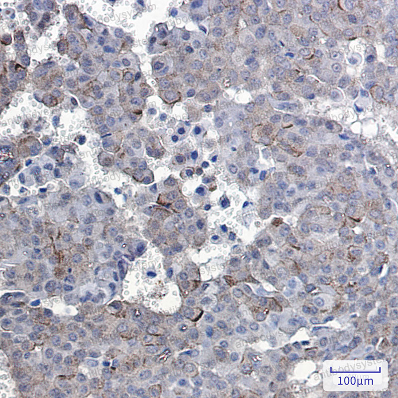 Anti-Phospho-EGFR/ERBB1/HER1 (Tyr1092) Antibody (R1H30)