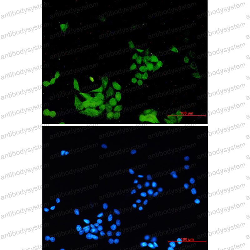 Anti-Phospho-EGFR/ERBB1/HER1 Antibody (R1H31)
