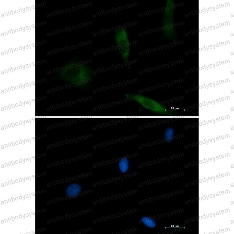 Anti-EGFR/ERBB1/HER1 Antibody (R1H32)