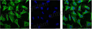 Anti-EGFR/ERBB1/HER1 Antibody (R2W78)
