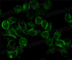 Anti-EGFR/ERBB1/HER1 Antibody (R2W80)
