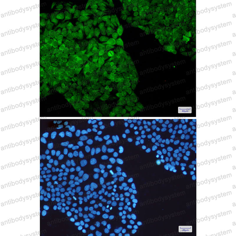 Anti-PGK1 Antibody (R1H34)