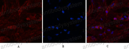Anti-LALBA/alpha Lactalbumin Antibody (R2W82)