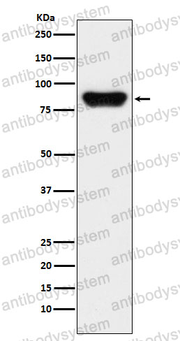 Anti-F2/Prothrombin Antibody (R1H35)