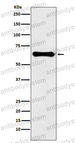 Anti-F9/Factor IX Antibody (R1H38)