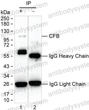 Anti-CFB/Complement factor B Antibody (R2W86)