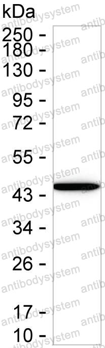 Anti-ADA/Adenosine deaminase Antibody (R2W87)