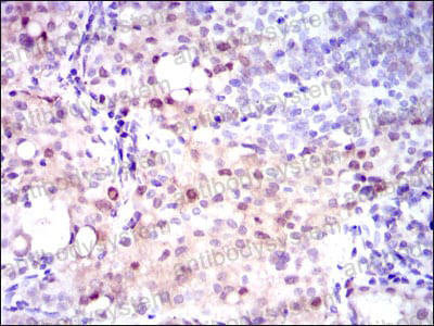 Anti-ASS1 Antibody (R2W89)