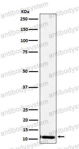 Western blot for Anti-SPINK1 Antibody (R1H50) ?>