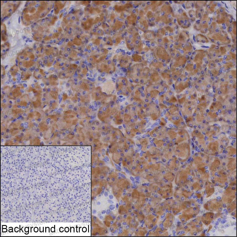 Anti-SPINK1 Antibody (R2W90)