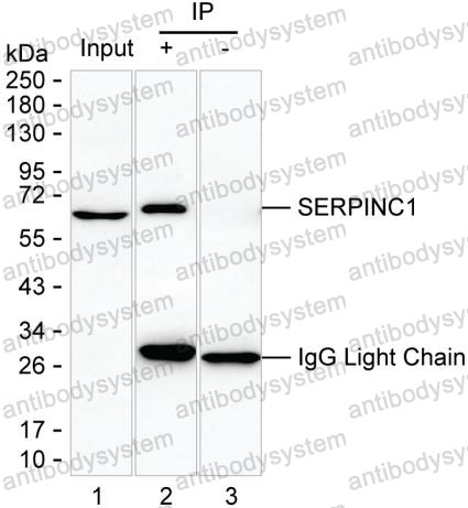 Anti-SERPINC1 Antibody (R2W91)