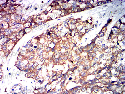 Anti-a1AT/Serpin A1/SERPINA1 Antibody (R2W95)