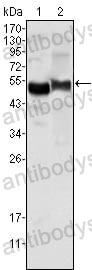 Anti-a1AT/Serpin A1/SERPINA1 Antibody (R2W93)