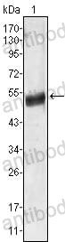 Anti-AGT Antibody (R2W98)