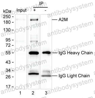 Anti-A2M Antibody (R2W99)