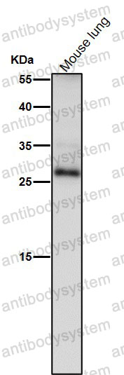 Anti-TIMP1 Antibody (R1H60)
