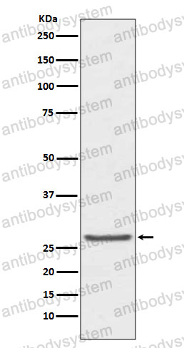 Anti-TIMP1 Antibody (R1H61)
