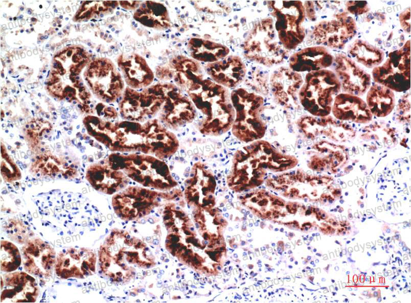 Anti-CST3 Antibody (R2X04)