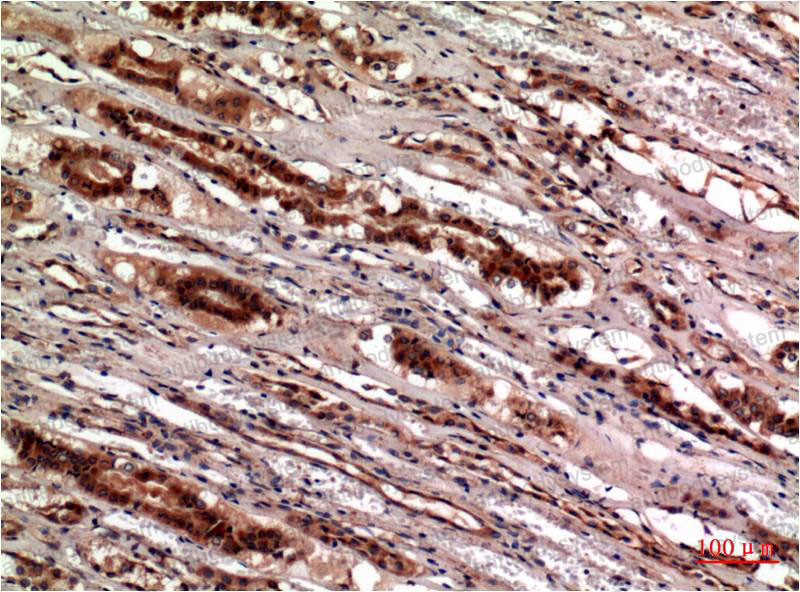 Anti-CST3 Antibody (R2X05)