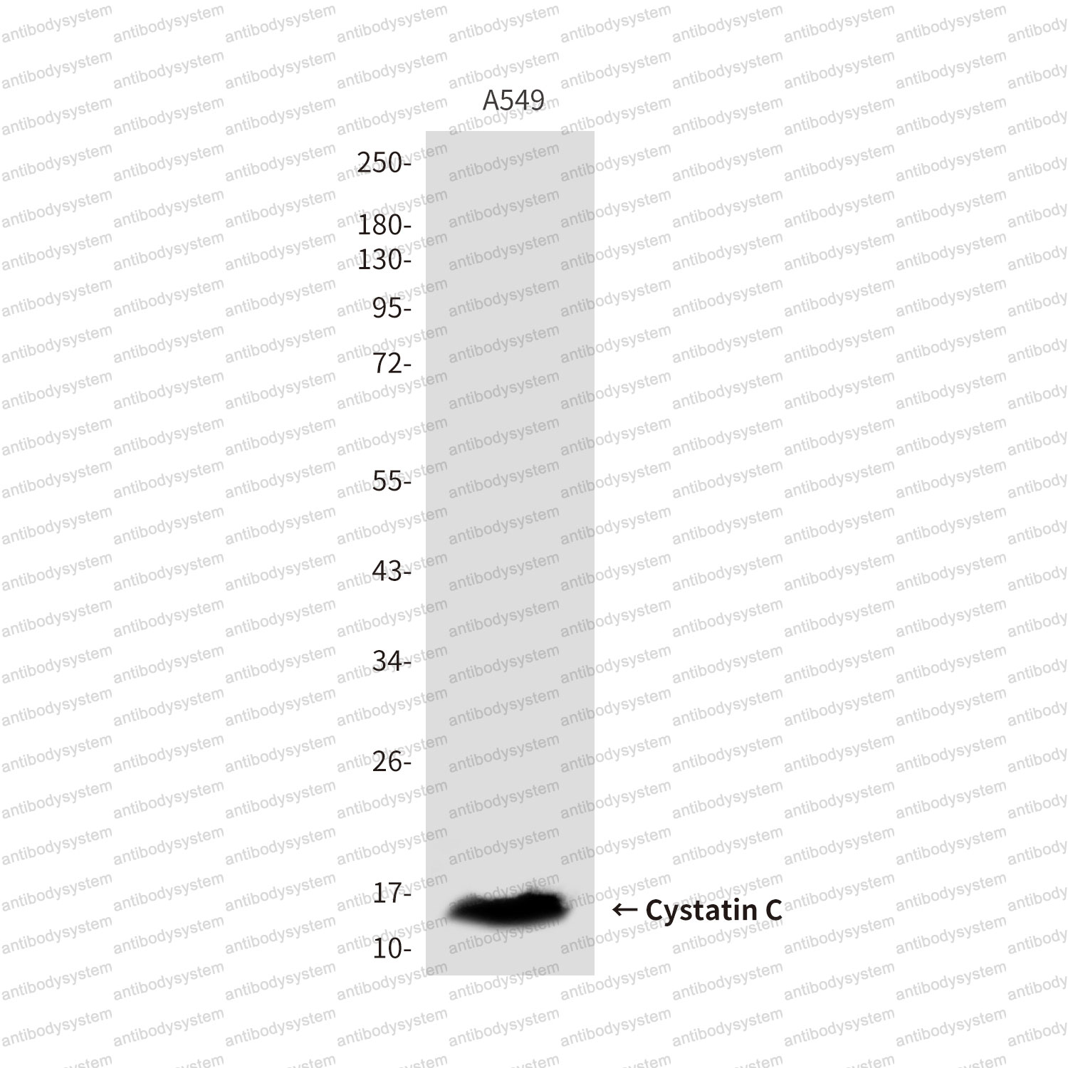 Anti-CST3 Antibody (R2X06)