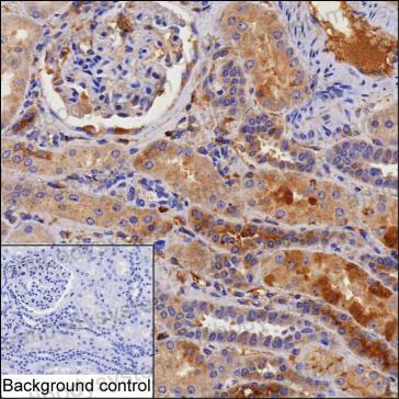 Anti-KNG1 Antibody (R2X08)