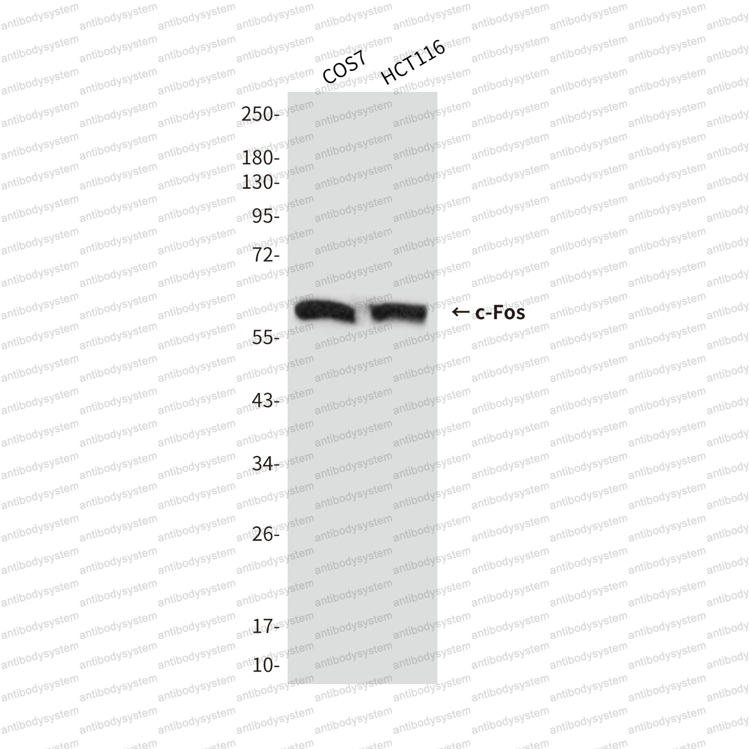 Anti-FOS/c-Fos Antibody (R2X10)