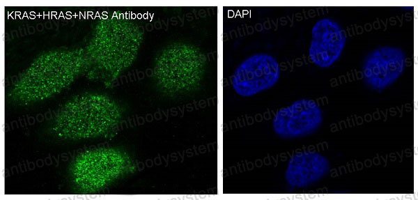 Anti-KRAS/HRAS/NRAS Antibody (R1C43)