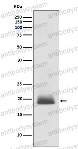 Anti-NRAS/Ras Antibody (R1H67)