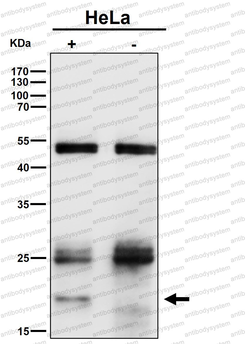 Anti-HRAS Antibody (R1A94)