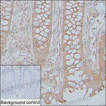 Anti-KRAS/K-Ras 2 Antibody (R2X13)