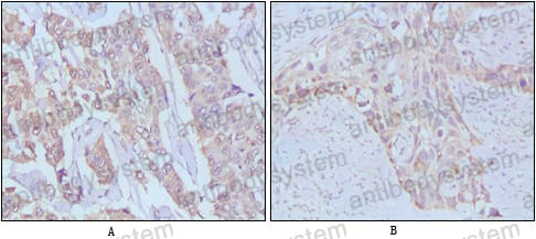 Anti-EGF Antibody (R2X16)