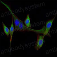 Anti-EGF Antibody (R2X17)