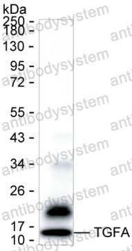 Anti-TGFA/TGF-alpha Antibody (R2X18)