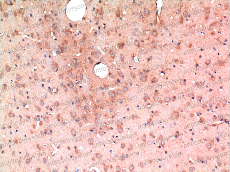 Anti-TGFB1/TGF-beta-1 Antibody (R2X21)