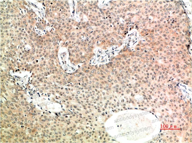 Anti-TGFB1/TGF-beta-1 Antibody (R2X22)