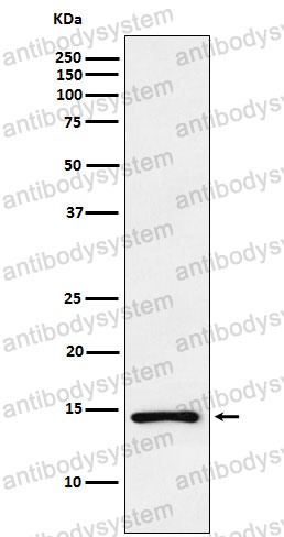 Anti-NPPA Antibody (R1H75)