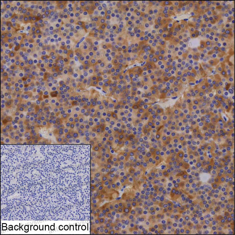 Anti-LHB Antibody (R2X30)