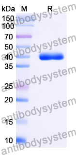 Anti-Human TG/Thyroglobulin Antibody (SAA0534)