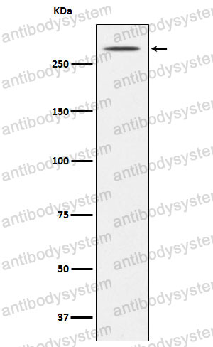 Anti-TG/Thyroglobulin Antibody (R1H77)