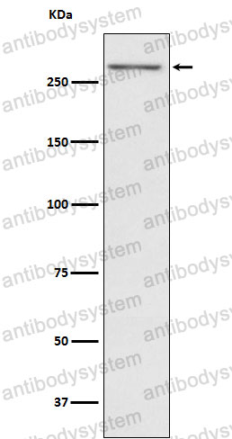 Anti-TG/Thyroglobulin Antibody (R1H78)